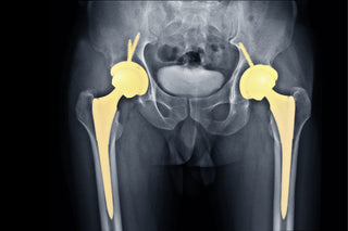 Fra smerte til styrke: Min reise tilbake – og hva du kan lære av den